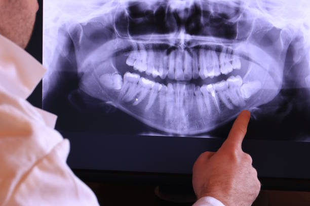 Best Emergency Treatment for Oral Infections in Inman, SC